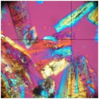 zrnkový preparát    
KYSELINA MOČOVÁ
(polarizační mikroskop) 